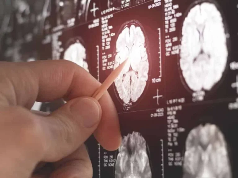 Η λύση δεν είναι ο αποκλεισμός ειδικοτήτων, αλλά η σωστή εκπαίδευση και η συνεργασία