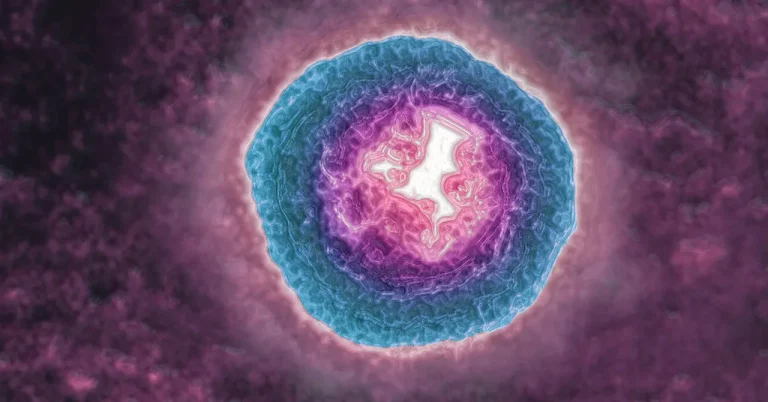 Ο ιός του έρπητα ζωστήρα μπορεί να σας γεράσει πιο γρήγορα