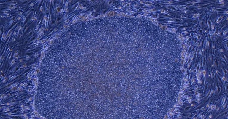 Η Ιαπωνία εγκρίνει την πρώτη θεραπεία στον κόσμο που γίνεται με επαναπρογραμματισμένα ανθρώπινα κύτταρα